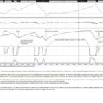 Road Atlanta Data Map